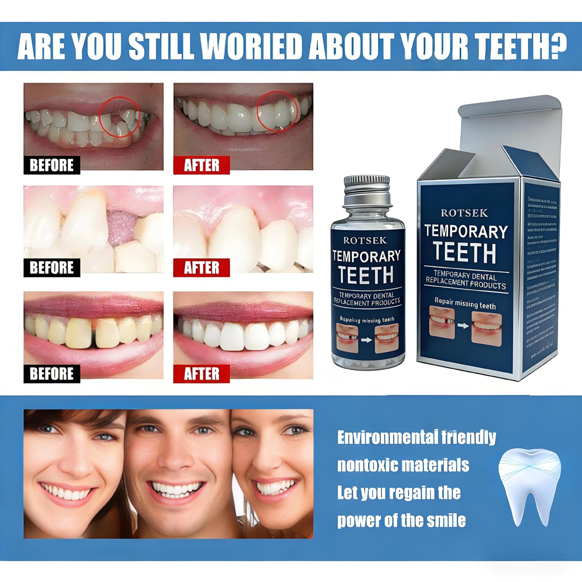 Cross-Border Moldable Plastic Dentures 30g Temporary Tooth Repair Adhesive Hot Search Terms Moldable Plastic Dentures