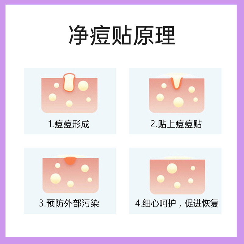 Hydrocolloid PE laser color star acne patch 40 cover bag in stock source factory wholesale southeast Asia