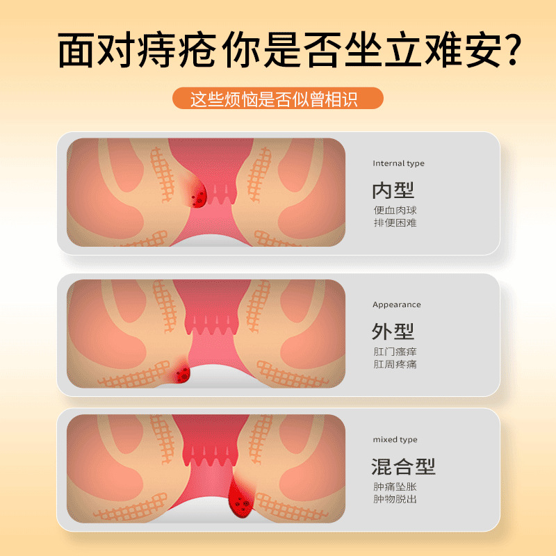 Sunflower Medical Carbomer Hemorrhoids Dressing Internal and External Mixed Hemorrhoids Men and Women Hemorrhoids Pain Restless Hemorrhoids Cream