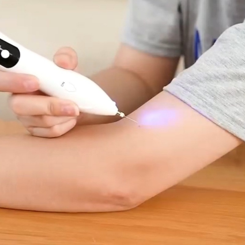 Маленькая белая ручка для удаления родинок, электрическая ручка для удаления пятен, миниатюрный лазерный косметический инструмент с ЖК-дисплеем