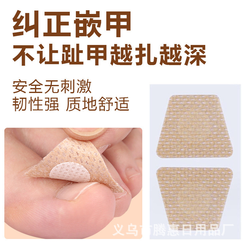 Nail care patch inlaid nail groove into the meat long toe pad protective patch soft nail onychomycosis orthopedic patch wholesale