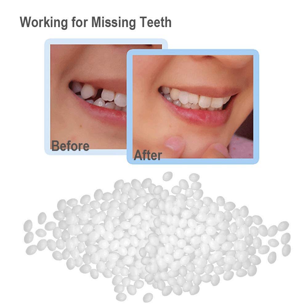 DIY repair gutta percha temporary tooth filling false shapeable tooth glue instant smile