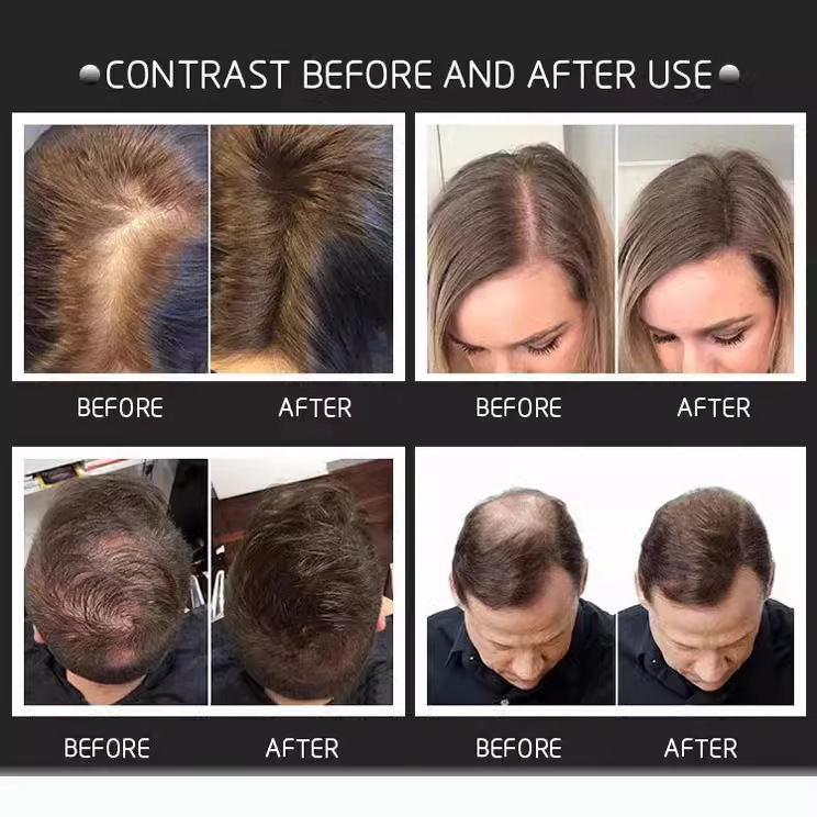 Cross-Border Top Hair Fiber Powder 27.5g Windproof Disposable Thickening Hair Fiber Hairline Filling Hairdressing Powder