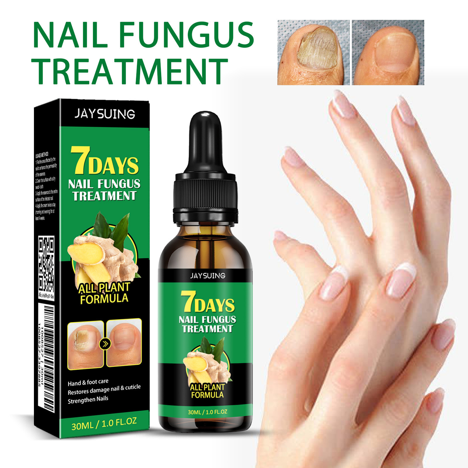 Jaysuing Ginger Nail Care Solution Protects Onychomycosis and Repairs Ginger Nail Care Solution