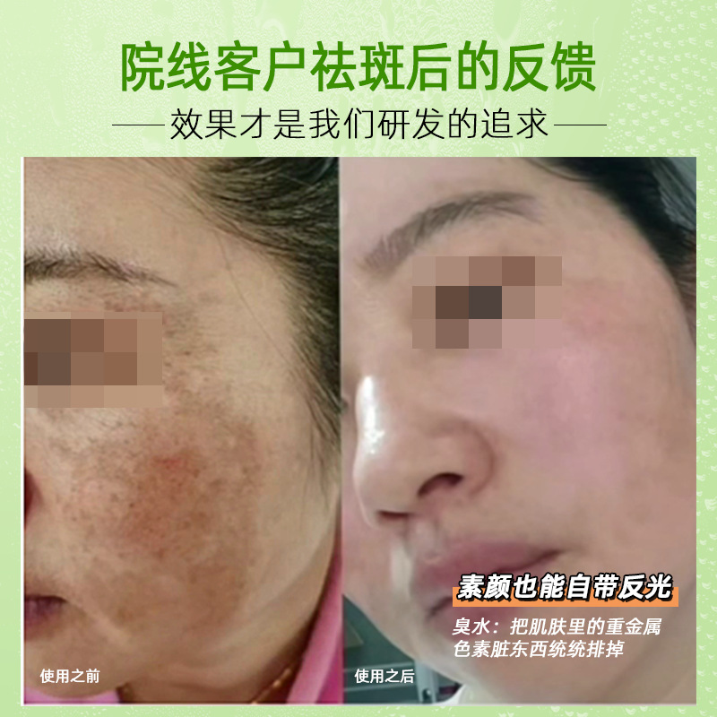 Toxic Water Removal Lead and Mercury Thiol Water Original Solution Whitening and Brightening Essence Anti-Darkening Hormone Removal Whitening and Freckle Removal Cosmetic