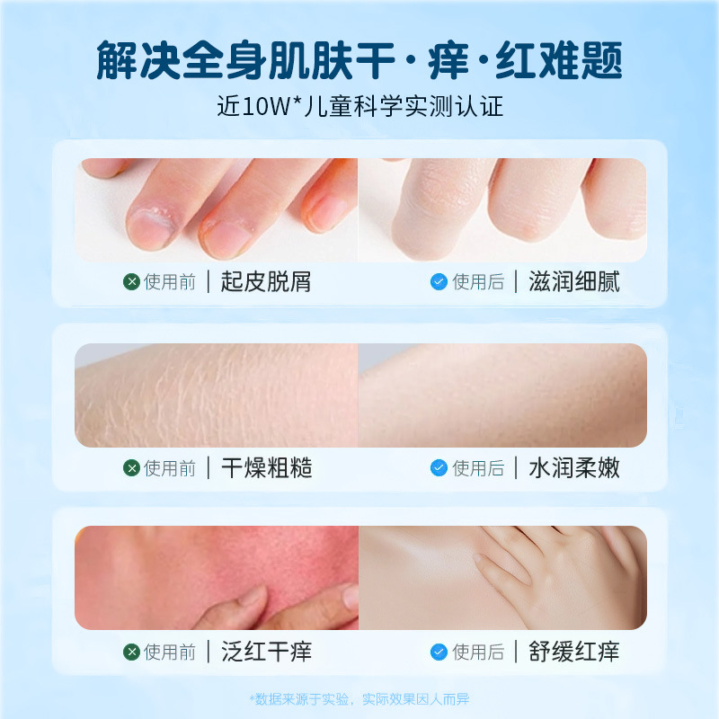 Children's Calendula Body Lotion Skin Lotion Autumn and Winter Baby Baby Special Moisturizing Anti-itching and Anti-drying Body Available