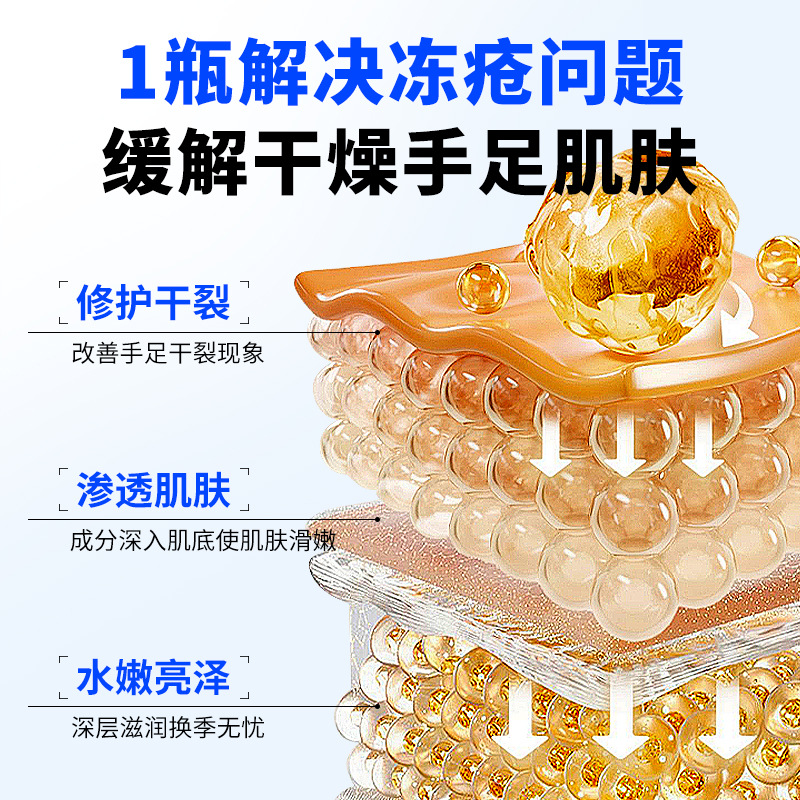 Nanjing Tongrentang Medical Frostbite Cream Anti-Freeze and Anti-Cracking Frostbite Hand Cream Frost-Cracked Hands and Feet Anti-Itch Frostbite Cream