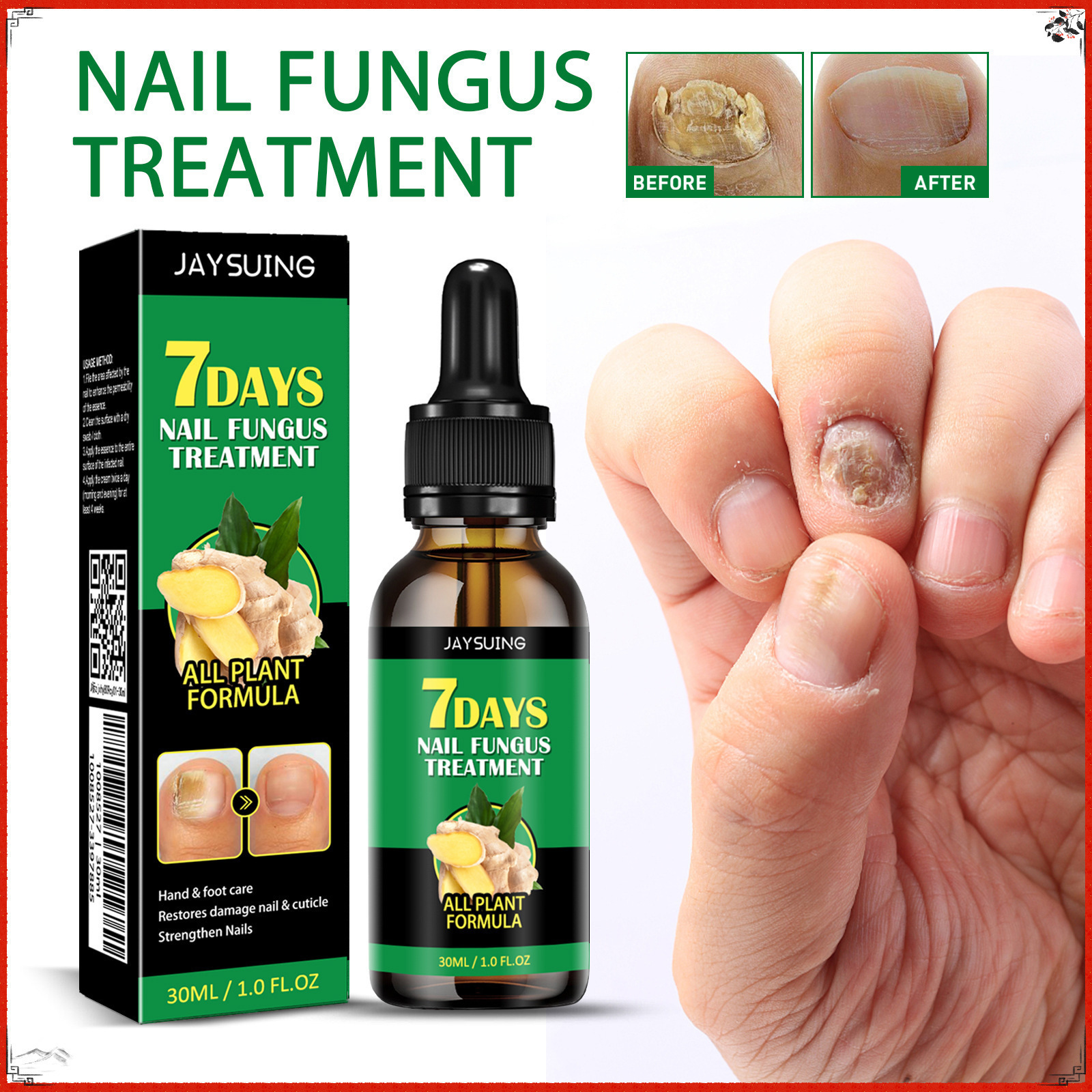 Jaysuing Ginger Nail Care Solution Protects Onychomycosis and Repairs Ginger Nail Care Solution