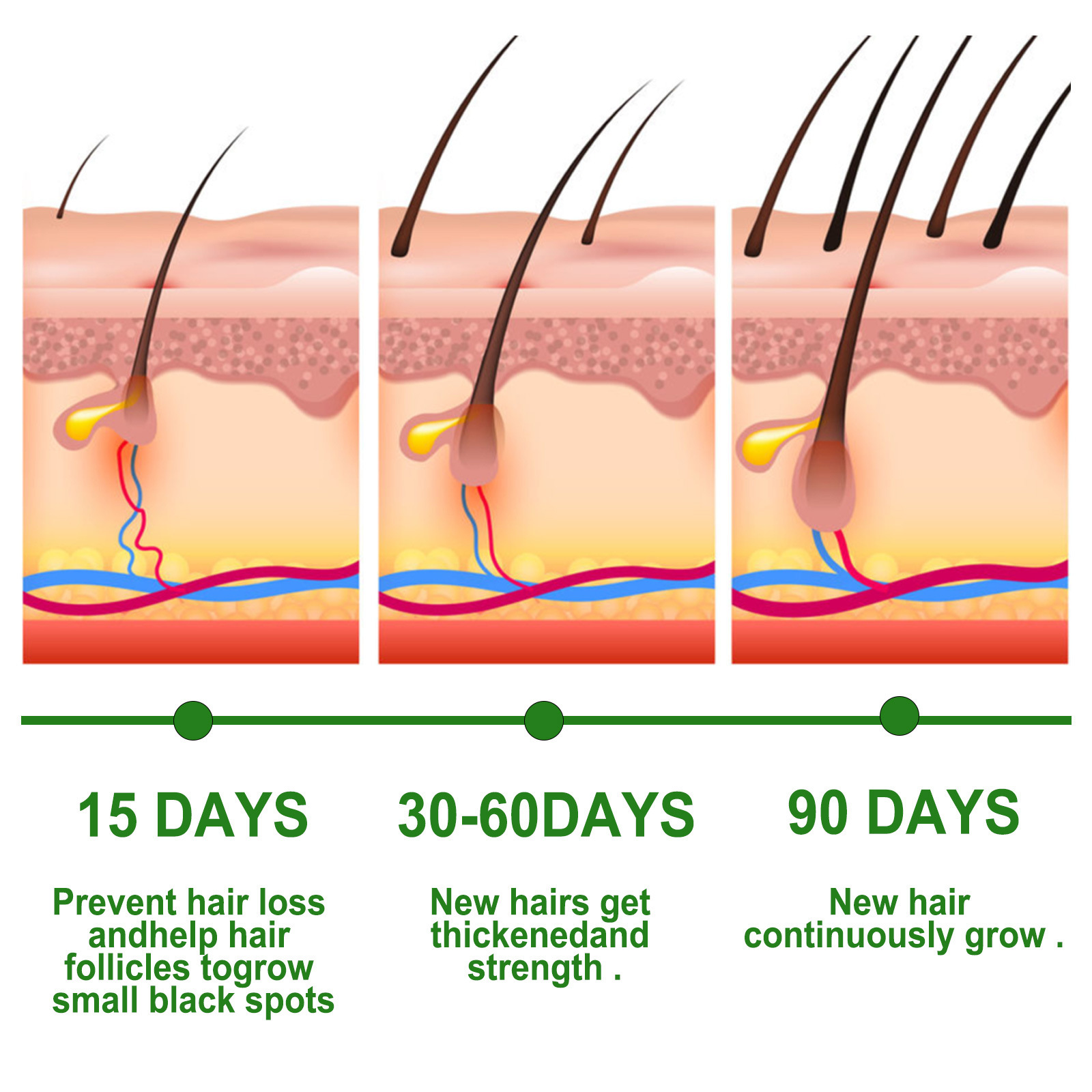 EELHOE Rosemary Hair Care Essential Oil Anti-Hair Growth Essential Oil Anti-Hair Care Nourishing Scalp Essential Oil