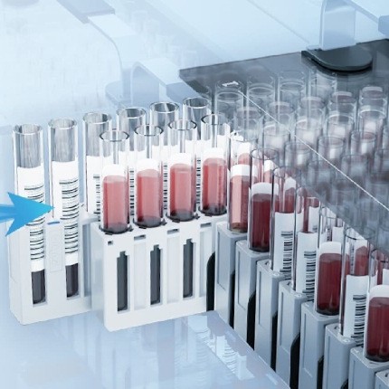 Zhongyuan Bio Exc 2000, a New Generation of Fully Automatic Biochemical Analyzer, Has Wide Applicability and Stable Quality