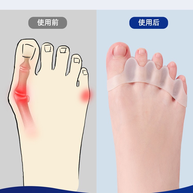 German Brand Toe Orthotic Toe Splitter Small Toe Thumb valgus Yoga Toe Splitter Men Women