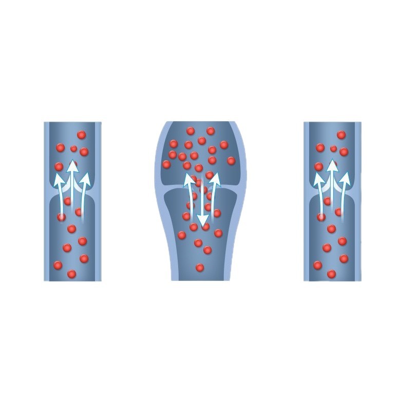 Xinzhangzhang Skin Color Mid-Tube Two-Level Open-Toe Medical Varicose Veins Elastic Socks Therapeutic Women's and Men's