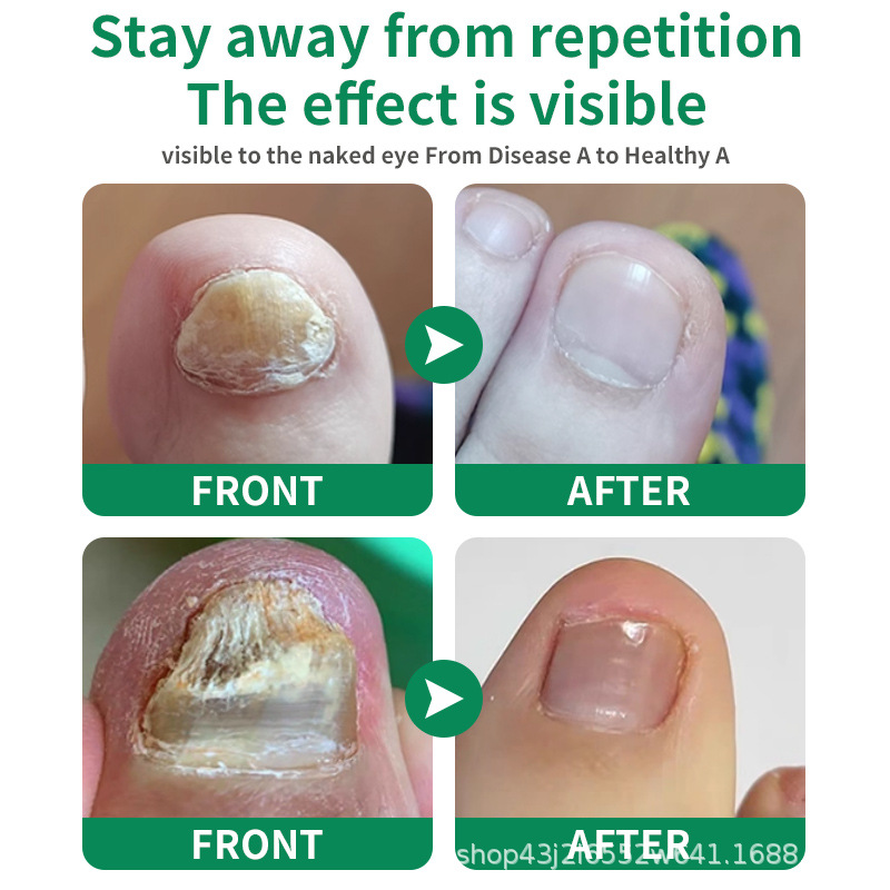 Cross-Border Full English Ginger Nail Care Solution Nail Care Hand and Foot Nail Moisturizing Care Solution Spot Wholesale