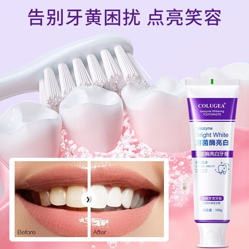 Lysozyme Whitening Toothpaste 100g Fresh Breath Stain Removal Toothpaste Whitening Teeth Oral Care Adult Toothpaste