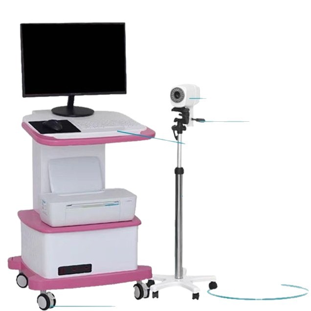 Xuzhou Xinma Electronic Colposcope Price Digital Colposcope Electronic Colposcope Digital System Mirror Manufacturer