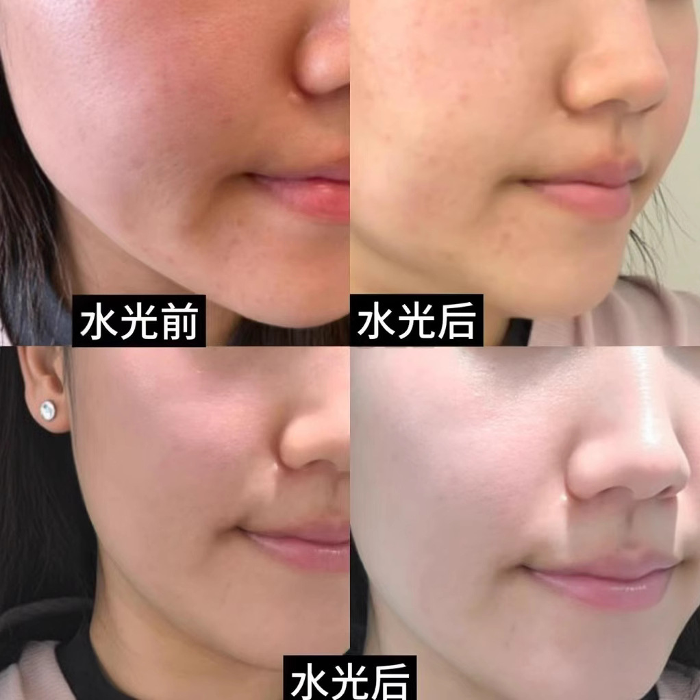 Water Light Essence Liquid, Special for Beauty Salons, Ampoule for Brightening and Hydrating, Non-Sticky Oe-M