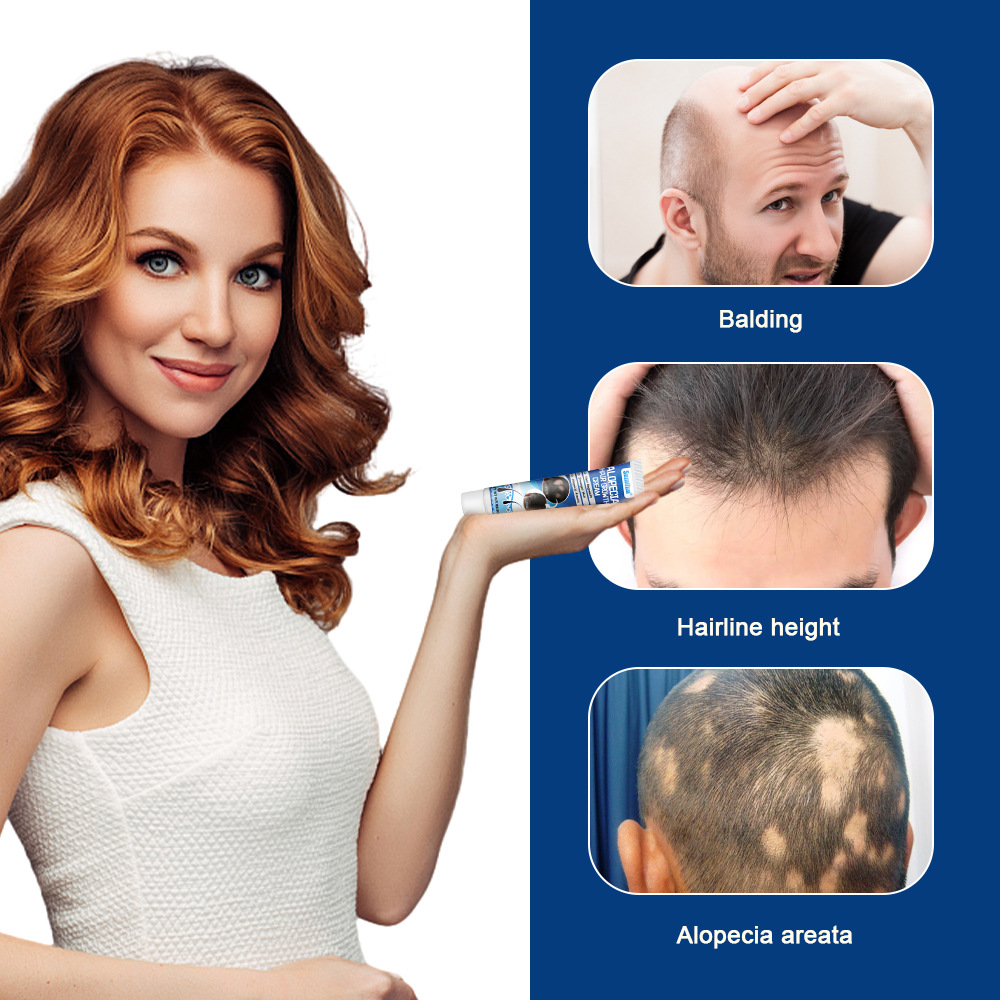 Sumifun Amazon Cross-Border Export Sophora Flavescens Alopecia Areata Cream Head Skin Care Cream Hair Care K10159