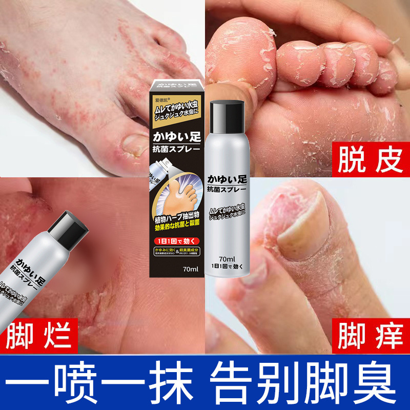 Japanese Wolf Venom Removal Athlete's Foot Medicine, Foot Odor Cream, Athlete's Foot Spray, Foot Odor Spray, Itchy, Peeling and Rotten Feet, Athlete's Foot Cream