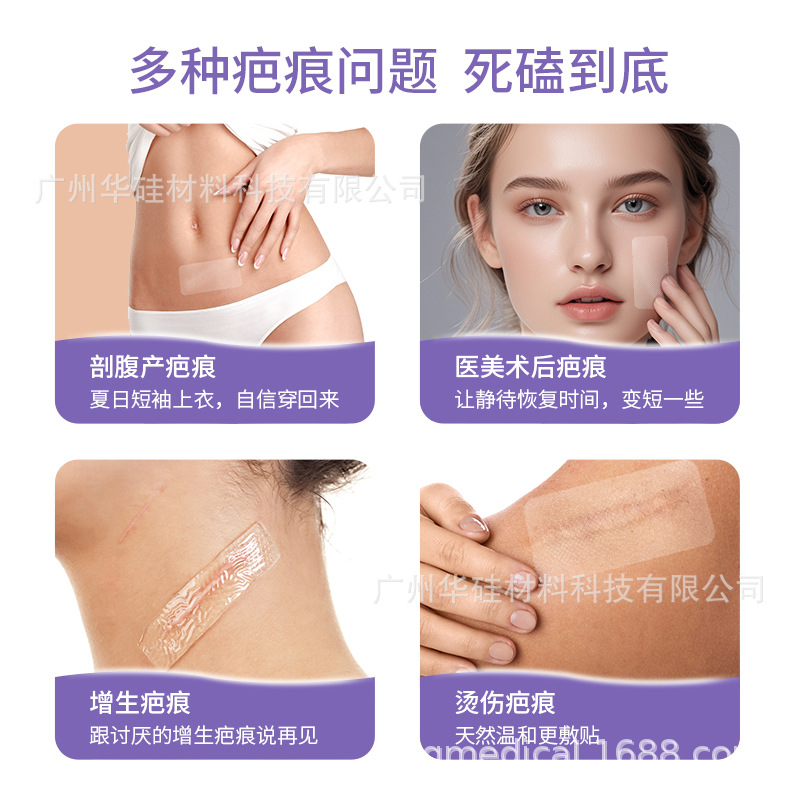 Cross-Border Supply of Silicone Gel Scar Patch American Fda Certified Skin Waterproof Tpu Scar Patch Stretch Mark Care