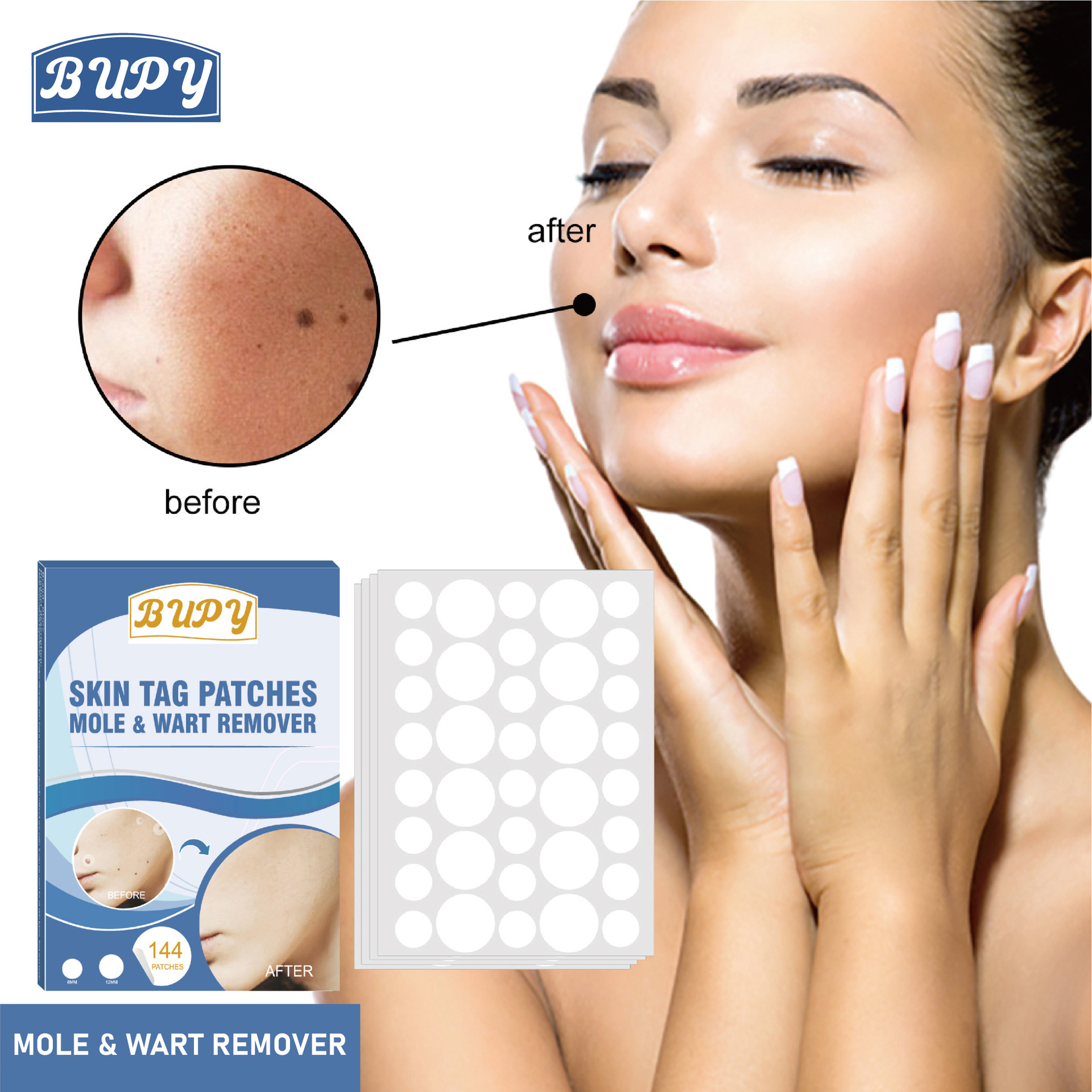 Патч для удаления бородавок, успокаивающий, для удаления мозолей, патч для удаления родинок