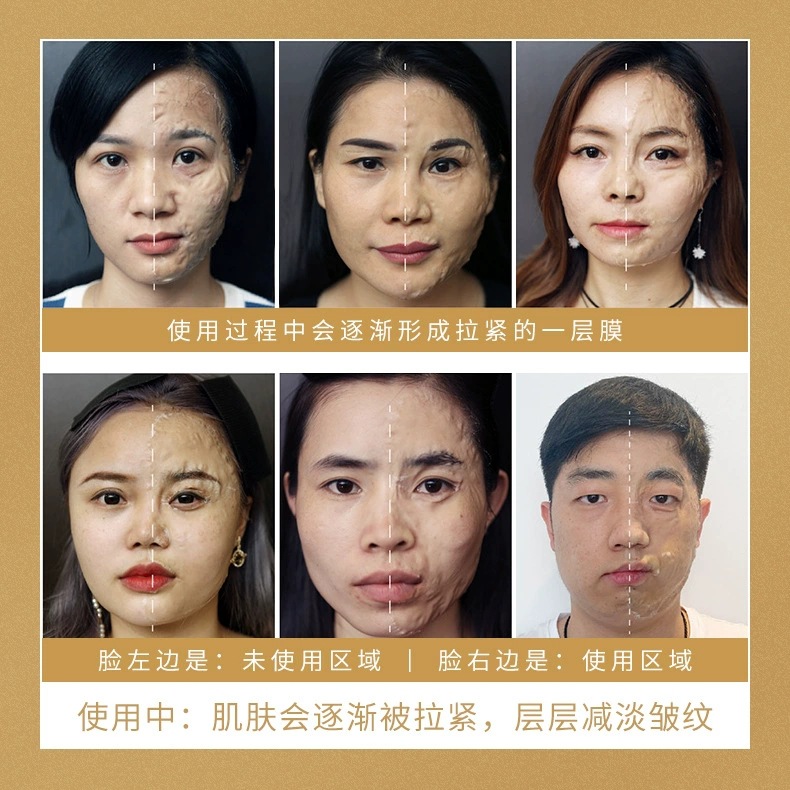 Polypeptide Firming and Rejuvenating Salon-Use Enzyme Mask V-Face Lifting and Tightening Collagen Mask Anti-Wrinkle Hydrating and Radiant