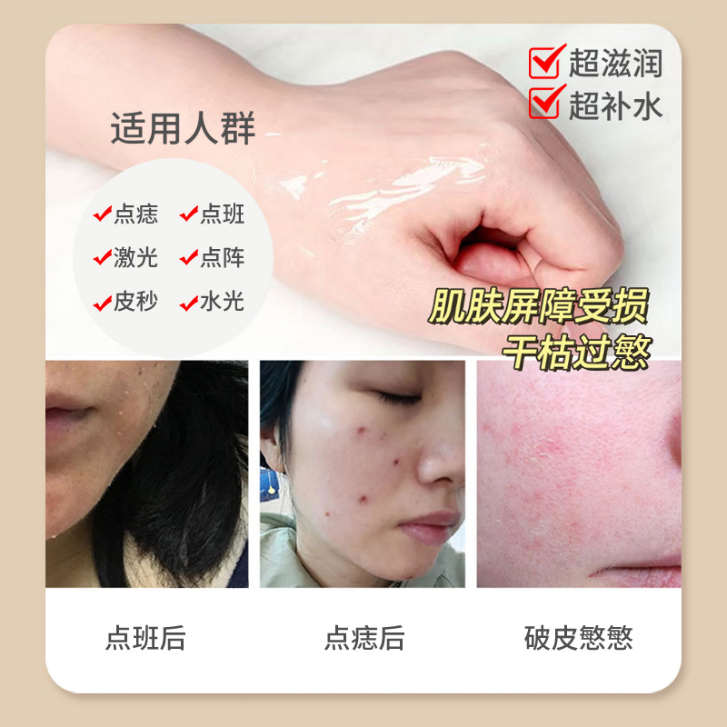 Growth Factor Cream Repairs the Epidermis, Laser Spots, Moles, Spots, Broken Skin, Zero Scab Repair, Peptide Repair, Skin Rejuvenation