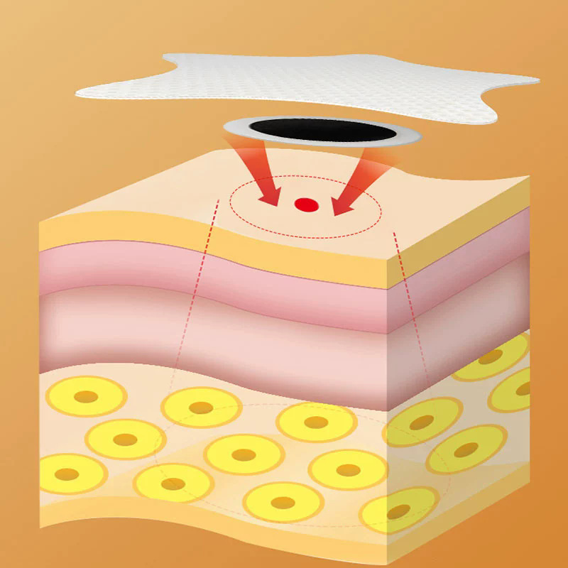 Nanjing Tongrentang Green Gold Codonopsis Fragrance Flatulence Health Care Patch 8 Foot Patch Flatulence Patch Kernel and Flatulence Patch Health Care