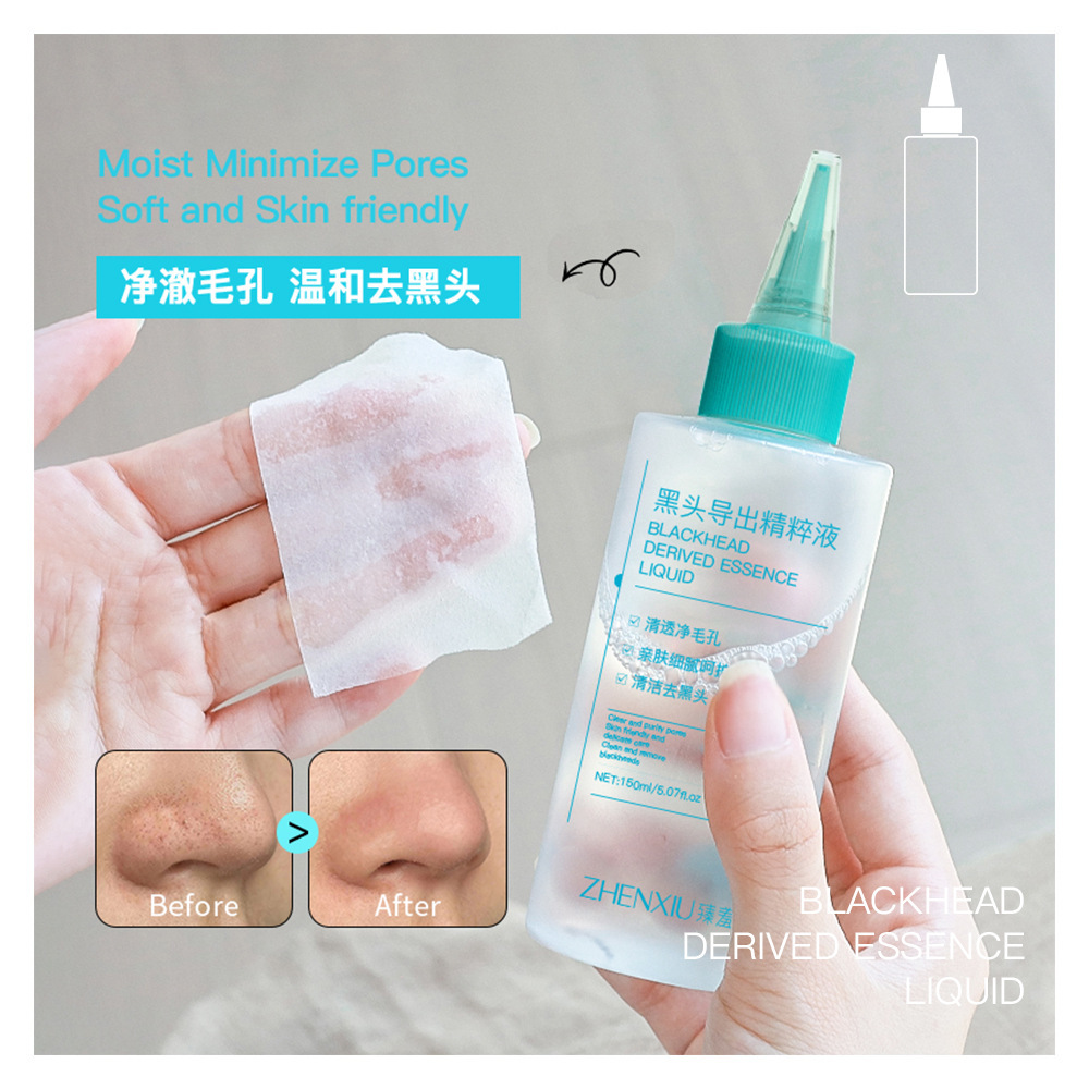 Zhenshy Blackhead Exporting Essence Hospital Gentle Acne Removal Pore Shrinking Water Wet Compress Cotton Dropshipping