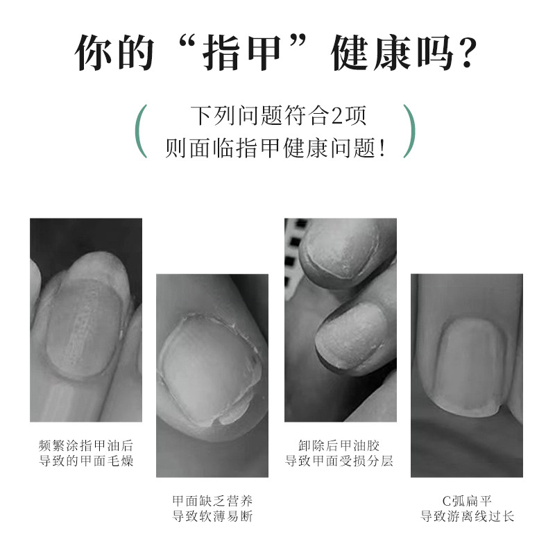 Manicure Finger Edge Oil, Nail Protection, Anti-Breakage Nutrition Pen, Nail Edge Care, Barb Nourishing Repair Solution Wholesale