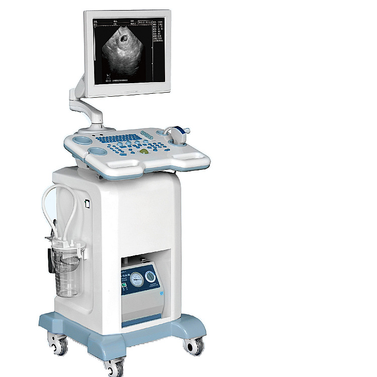 Gynecological Abortion Surgery Visual Abortion Machine Electric Suction Machine Color Ultrasound Abortion Machine Manufacturer Xuzhou Zhongma 47