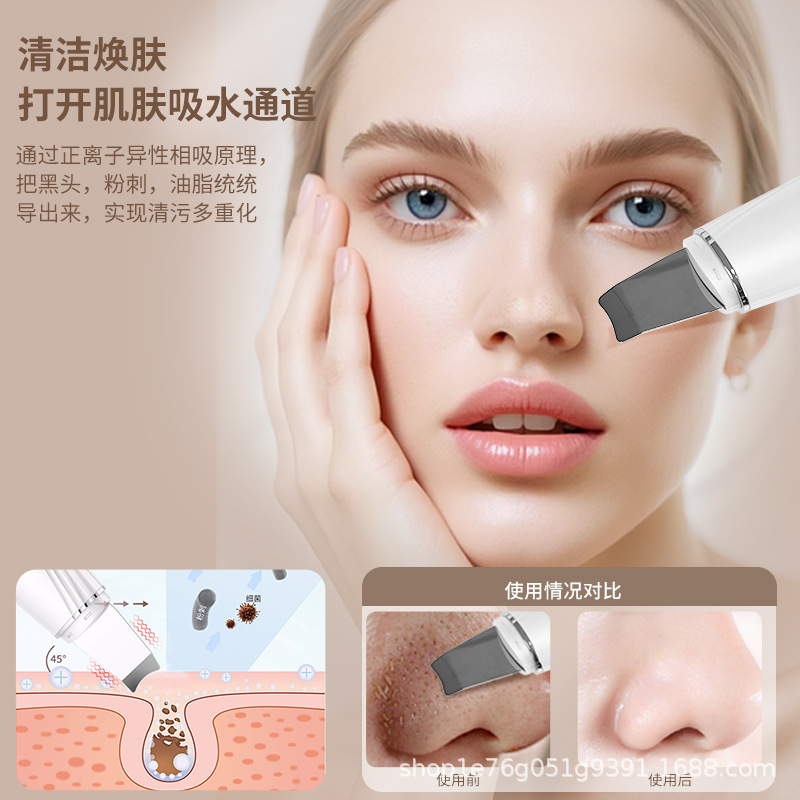 Cross-Border New Product Ems Peeling Knife Facial Import and Export Blackhead Grease Pore Cleaning Instrument Ultrasonic Peeling Machine