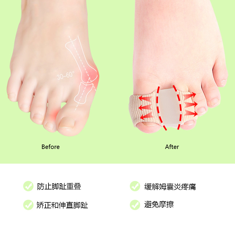 Cross-Border New Gel Fiber Toe Correction Big Toe Valgus Toe Separator Double Hole Toe Orthosis Nylon