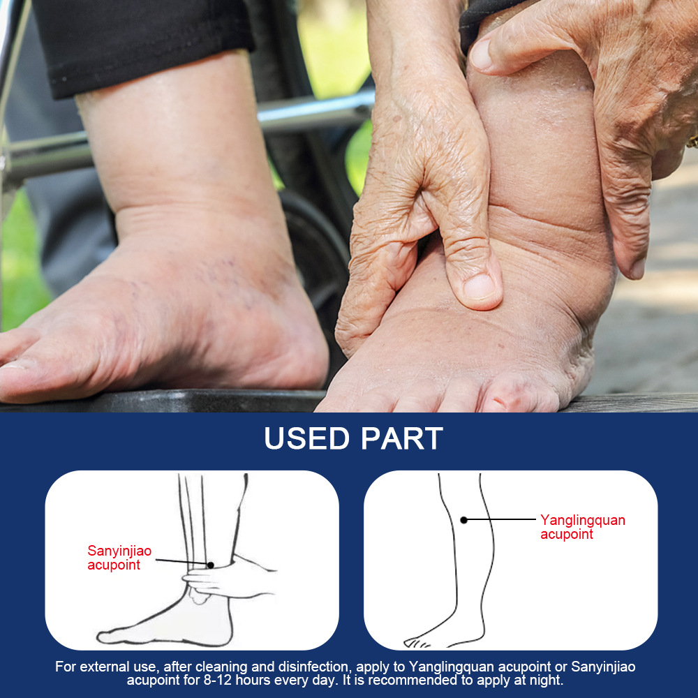 Sumifun Amazon Shopee Temu Cross-Border Edema Patch for Leg Swelling and Foot Care Health Patch K17301