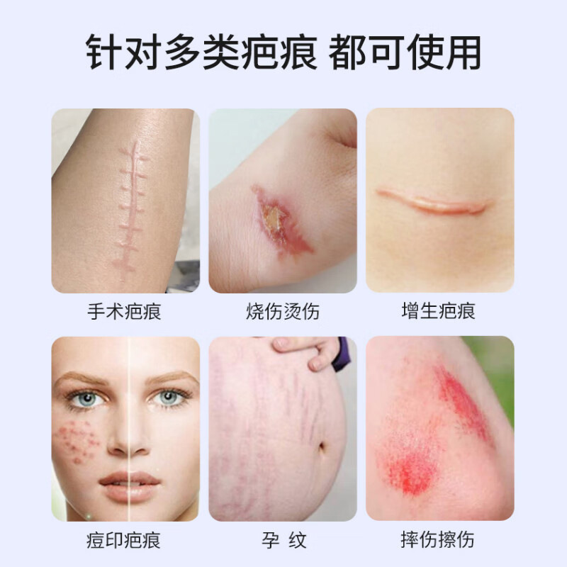 Oem Customized Scar Gel to Prevent Burn Scars and Hyperplasia, Medical Recombinant Collagen Scar Repair Gel