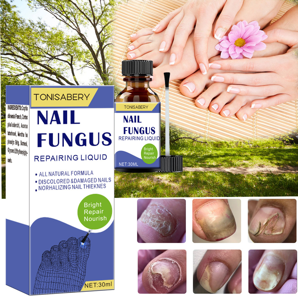 Cross-Border 30ml Nail Care Spray Repair Soft Nail Thickening Nail Onychomycosis Antibacterial Liquid Spray