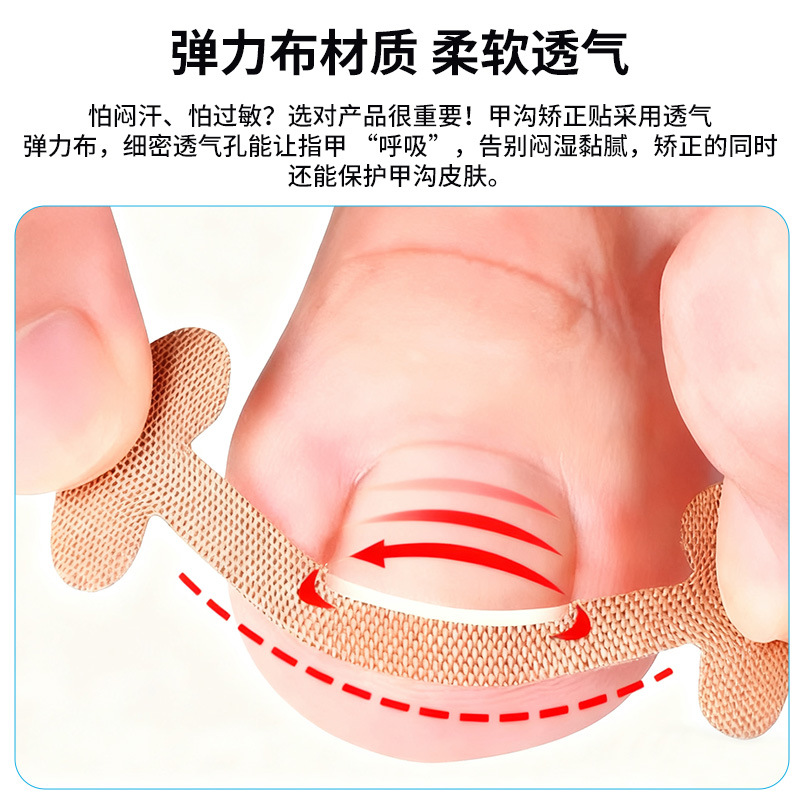 Toenail Correction Patch, Elastic Cloth Nail Groove Correction Patch, Disposable Nail Correction Patch, Nail Groove Correction Tool