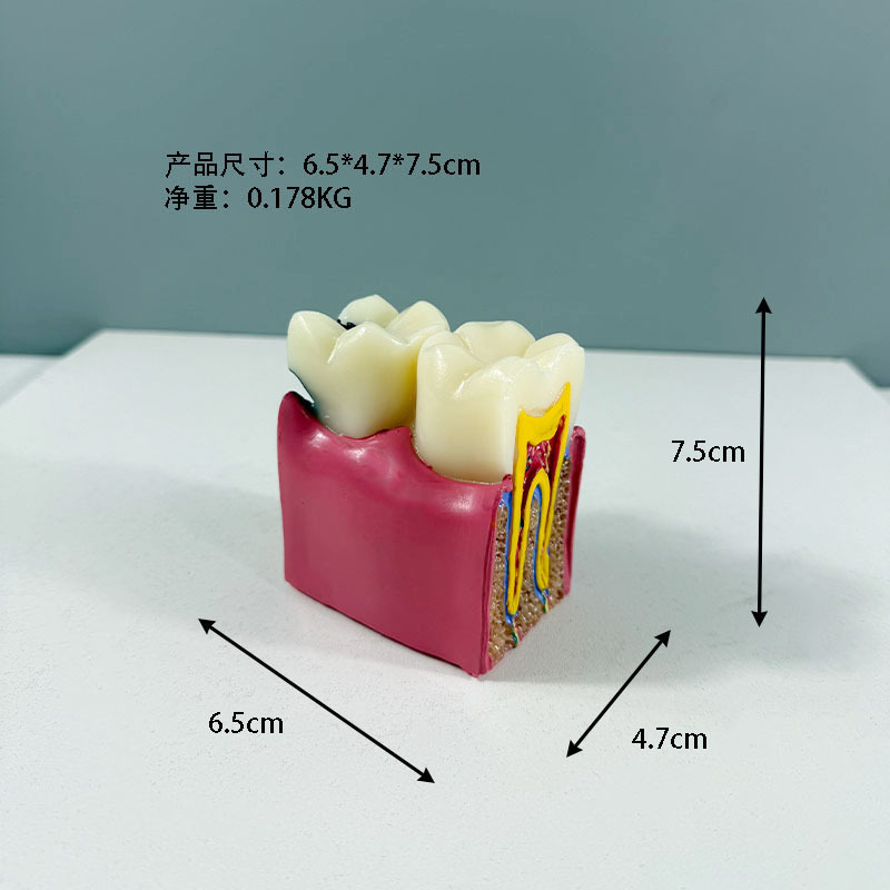 Production oral model dental model dental cavity section demonstration teaching dental model dental 6 times dental cavity comparison model