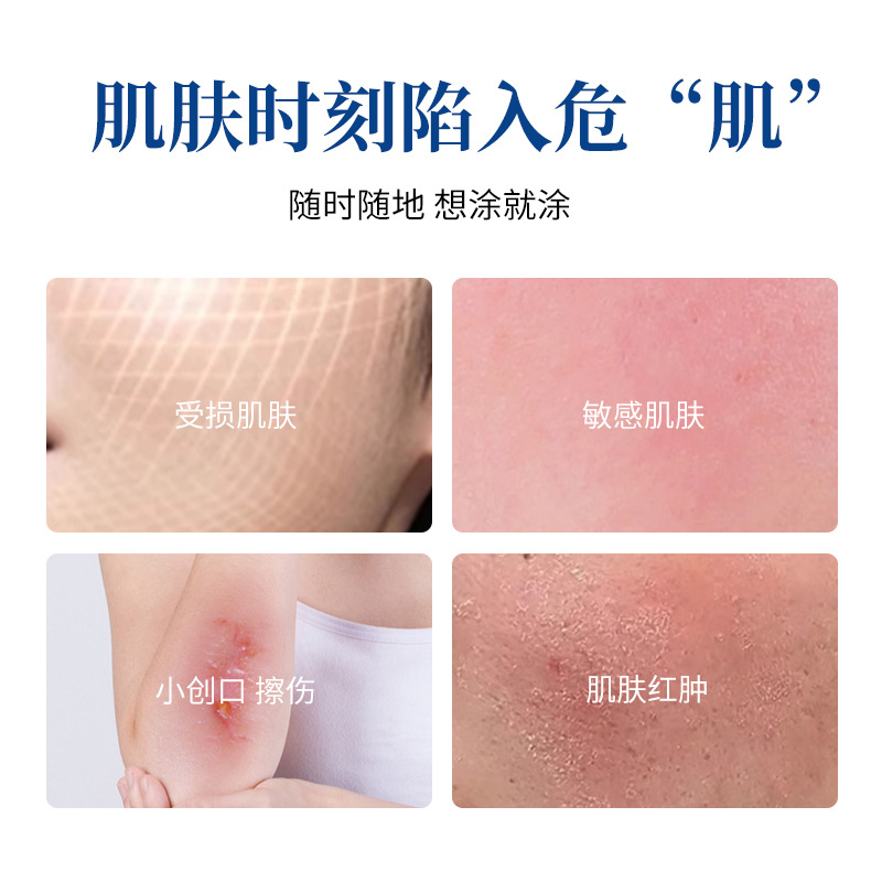 Medical Glucan Skin Dressing, Medical Beauty Micro-Surgery, Small Wound Non-Chronic Wound Care and Repair Skin Cream