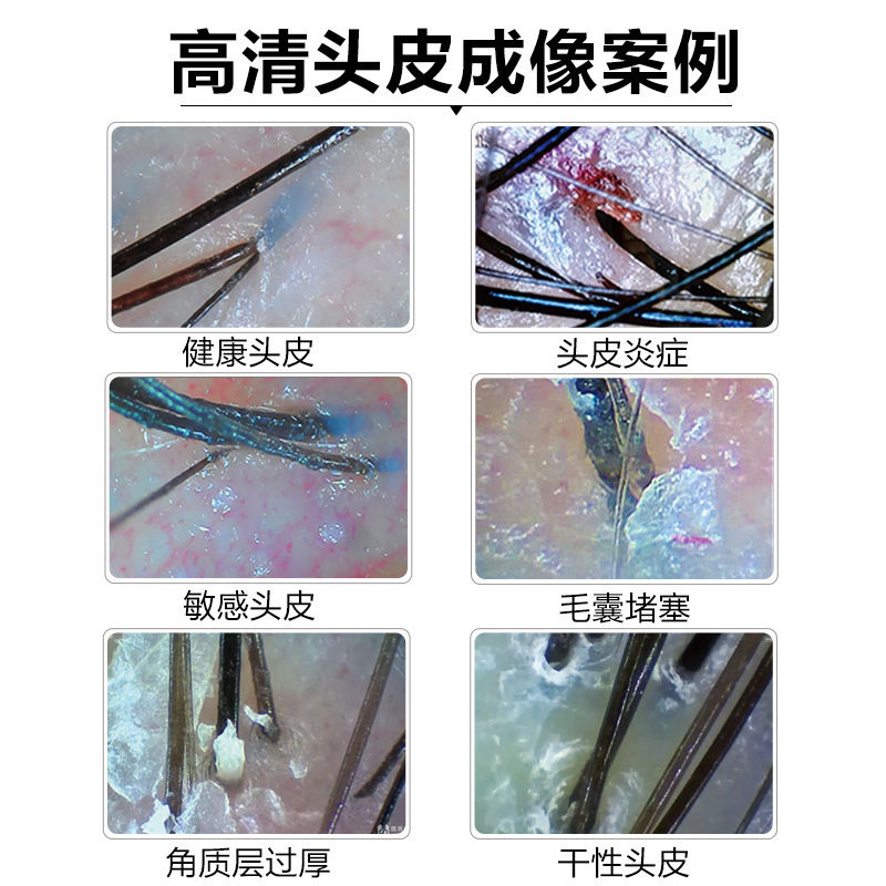 Hot Sale Portable Skin and Hair Analyzer Scalp Beauty Device