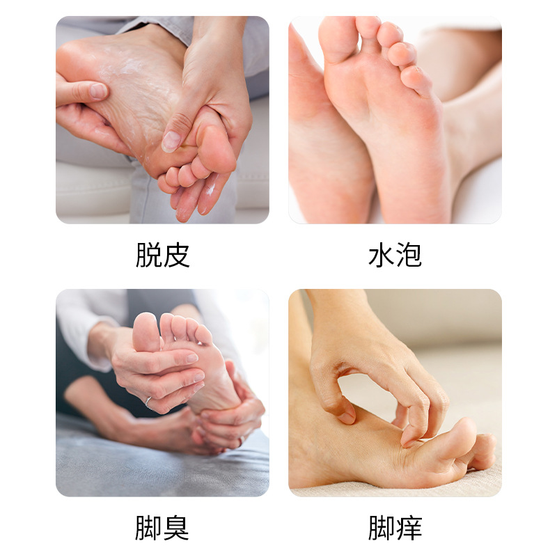 Special Chitosan Foot Relax Spray Athlete's Foot Hand Ringworm Fungal Infection Foot Care Wolfsbane Athlete's Foot Spray