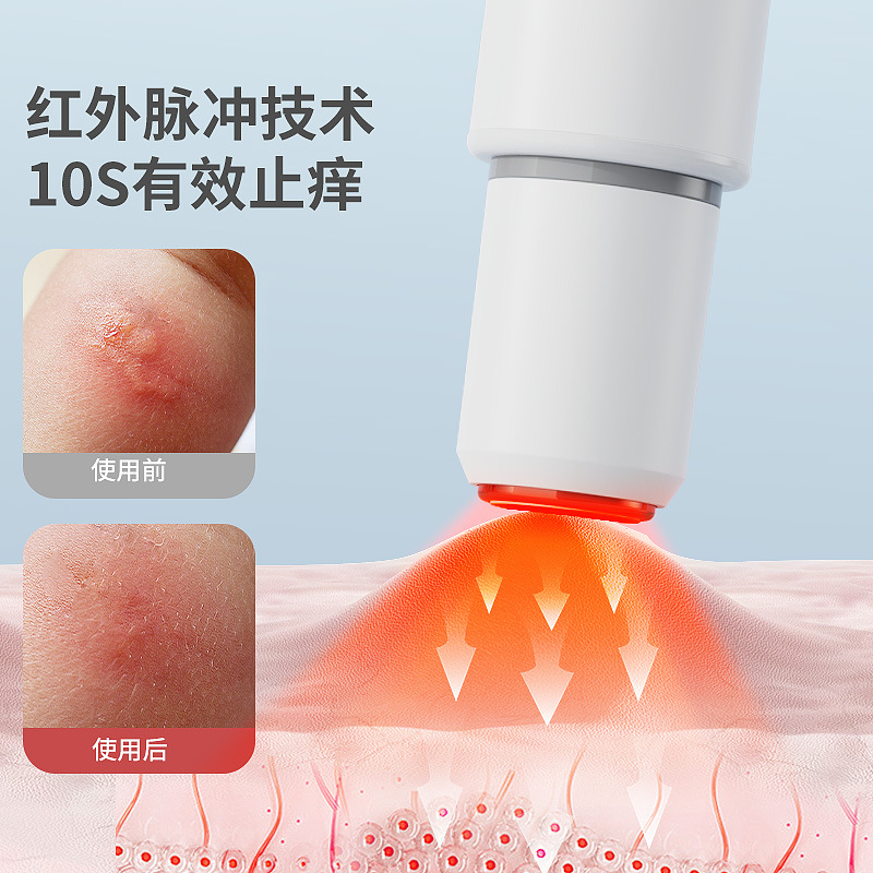 Cross-border Electric Antipruritic Outdoor Mosquito Bite Antipruritic Rechargeable Portable Bite Physical Antipruritic