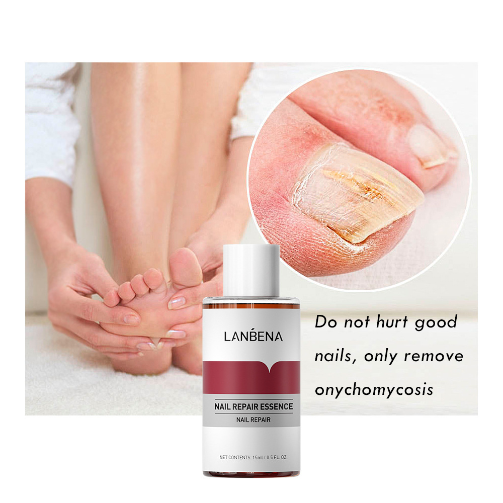 LANBENA Blue Beina Nail Essence Repair Care with 1 Small File 15ml