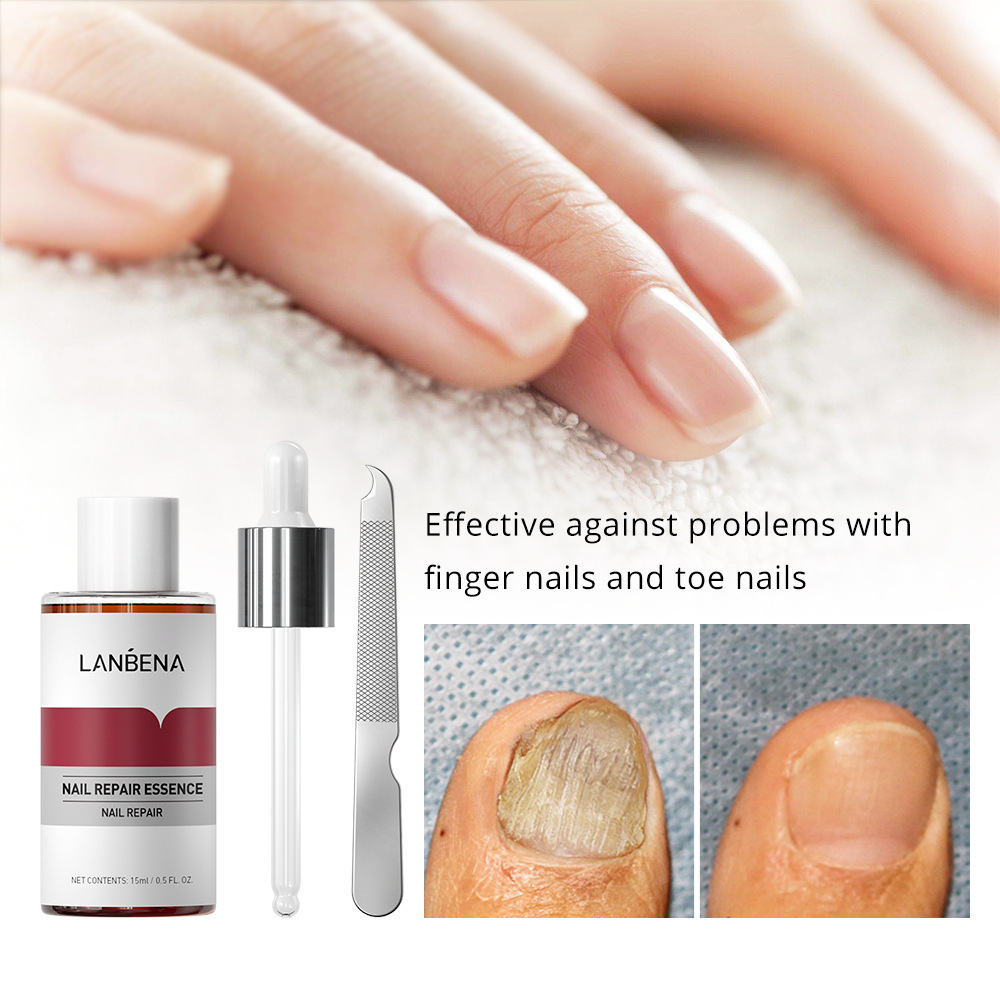 Lanbena Nail Repair with Small File 15ml (New Packaging)