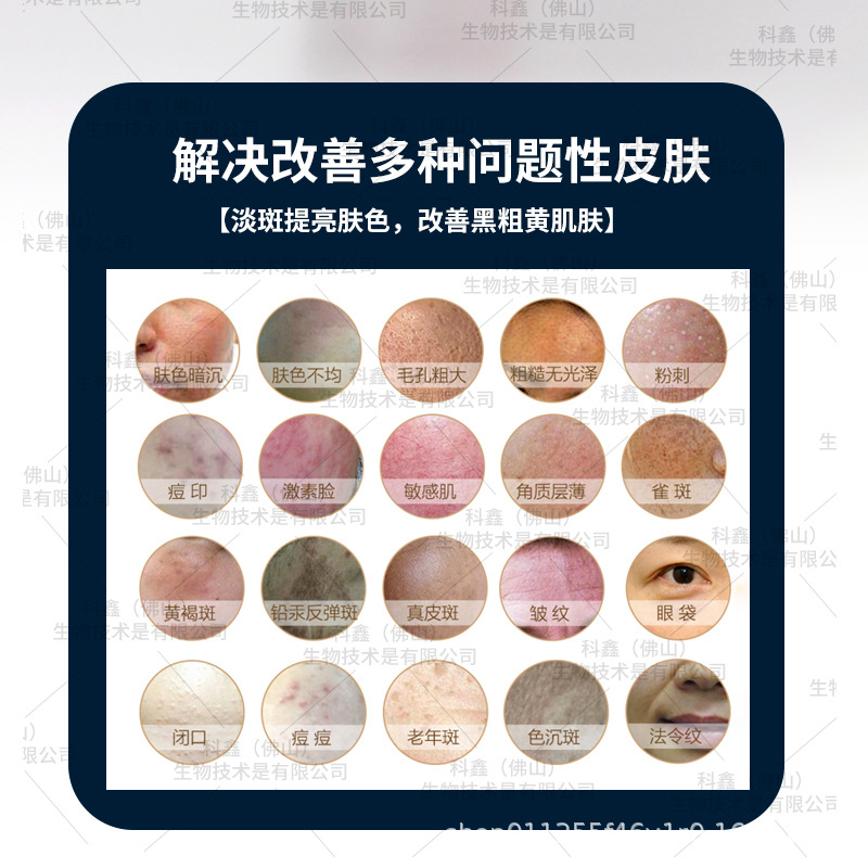 No embarrassment period to remove spots liquid color liquid desalination spots skin tone black thick yellow chloasma can wash face to do light bulb muscle