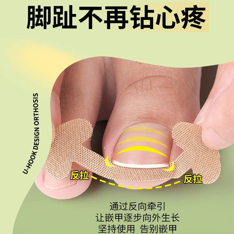 Glue-free nail sticking nail groove nail correction toe nail nail nail patch Lala manicure factory goods