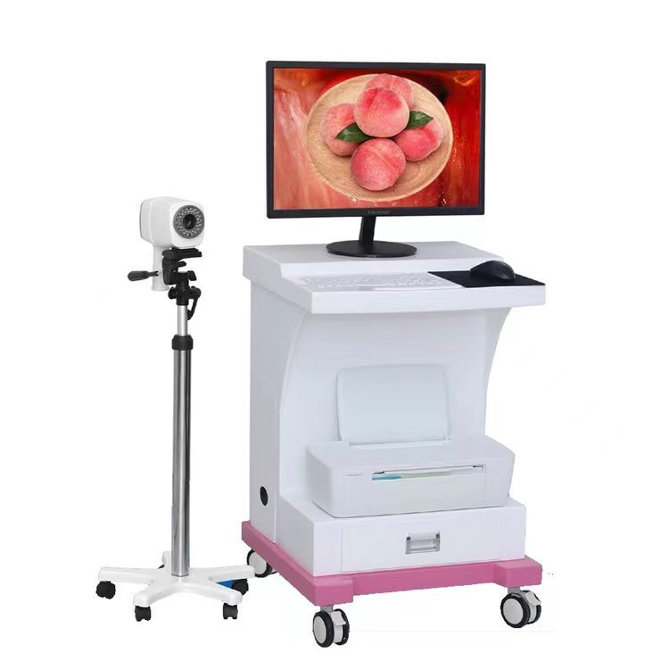 Electronic Vaginal Digital System Mirror 6000 Hd System Endoscope Gynecological Colposcopy System Maintenance Fee