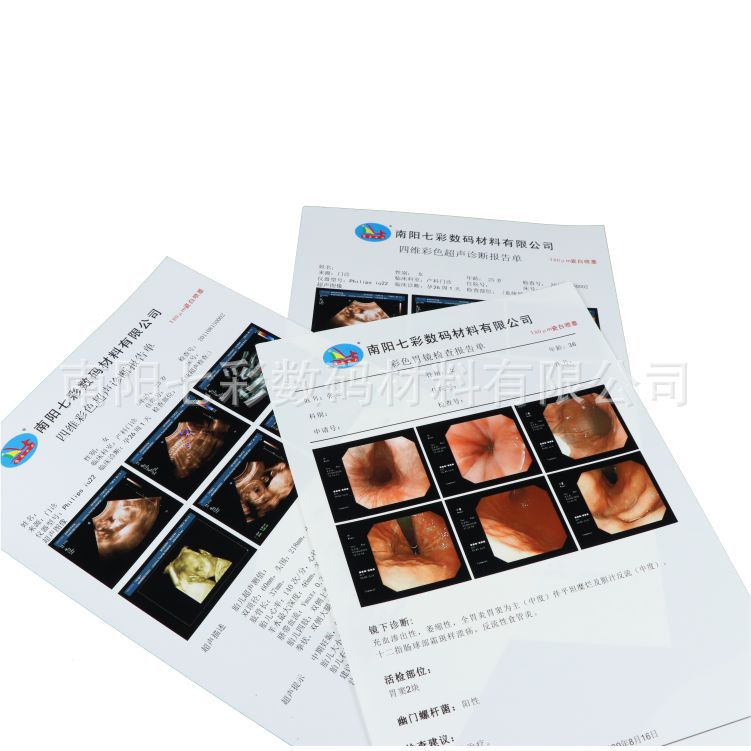 A4 medical porcelain white B ultrasound electronic gastrointestinal mirror white ink jet 150MB printing film