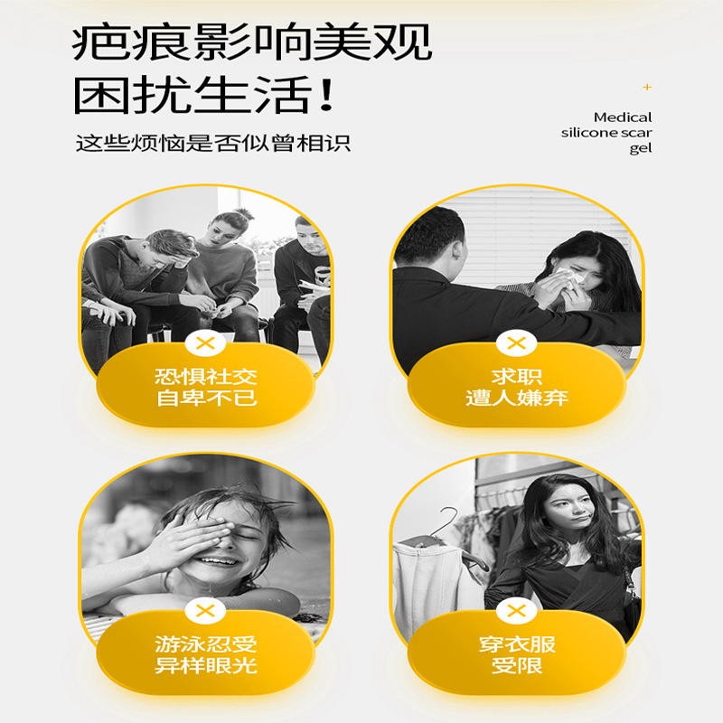 Sunflower medical silicone scar gel for children stretch marks fade scar cream scar cream genuine goods