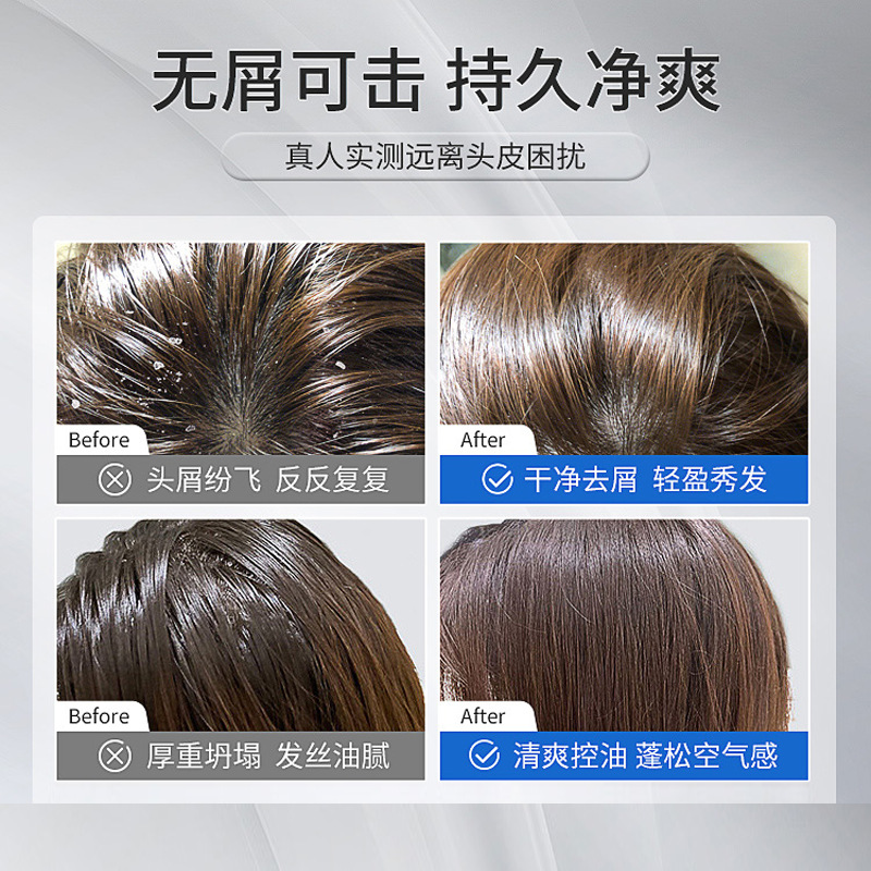 Selenium Disulfide Anti-Dandruff Shampoo Shampoo Oil Control Mite Removal Smooth and Fluffy Unisex Shampoo