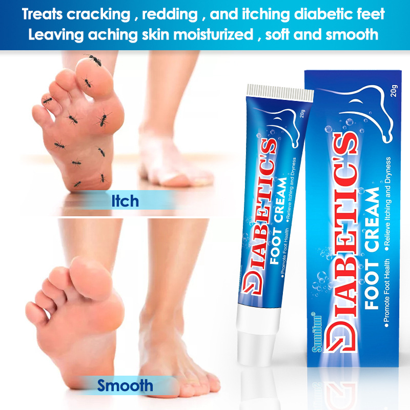 Sumifun Amazon Cross-Border Tangning Foot Ointment Foot Skin External Ointment Diabetic K10029